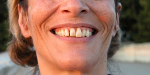 A Brief Look At Periodontal Surgery